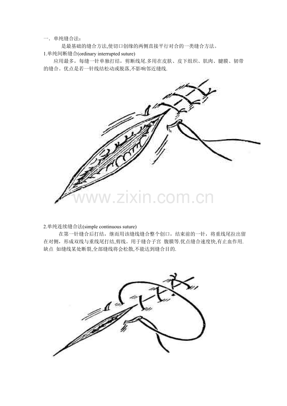 外科缝合的步骤和方法以及剪线的基本方法资料.doc_第2页