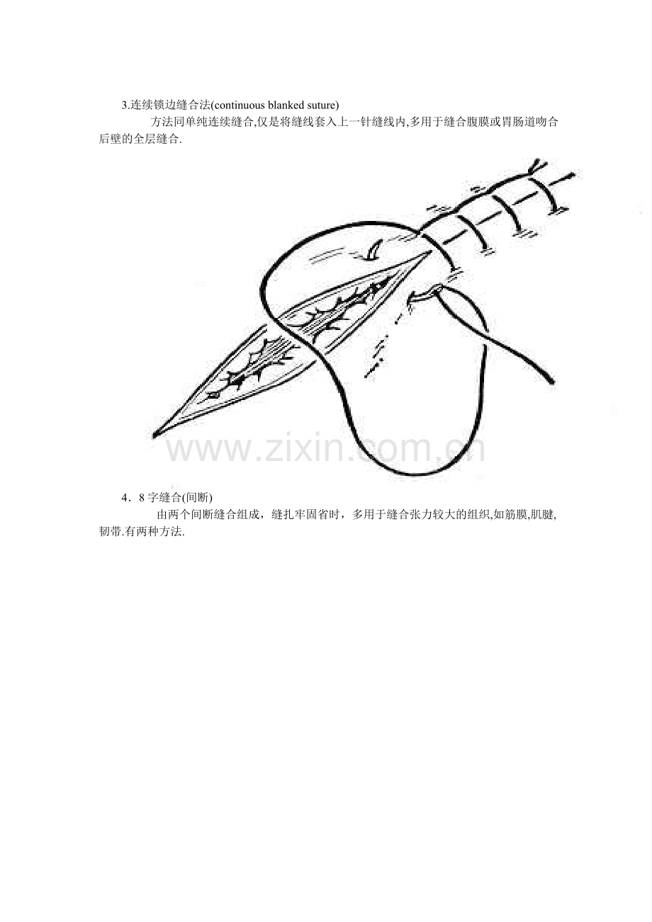 外科缝合的步骤和方法以及剪线的基本方法资料.doc_第3页