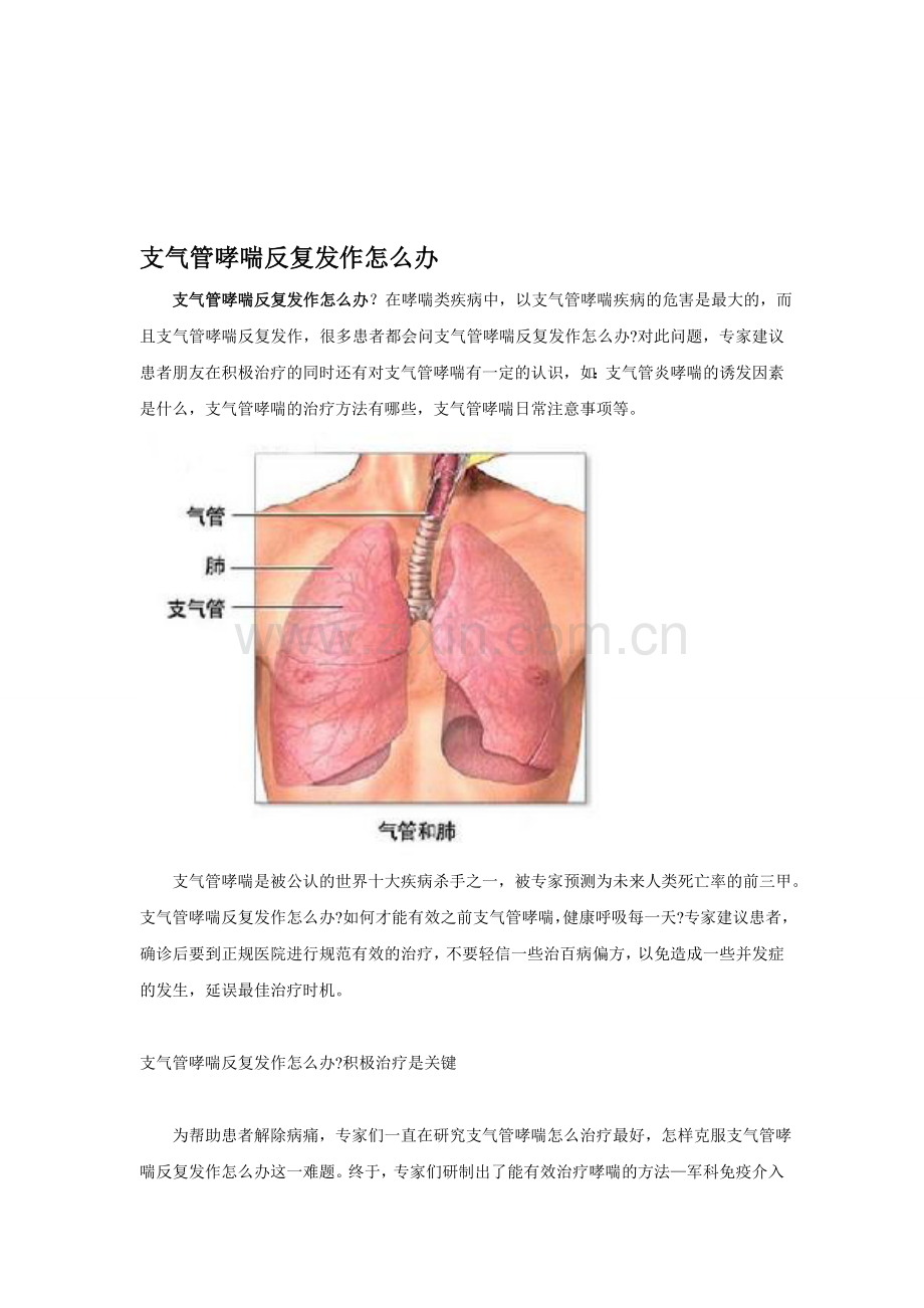 支气管哮喘反复发作怎么办.doc_第1页