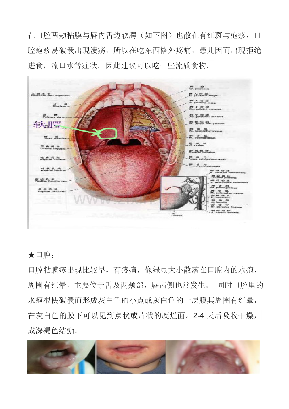 普通手足口病基本的症状为资料.doc_第2页