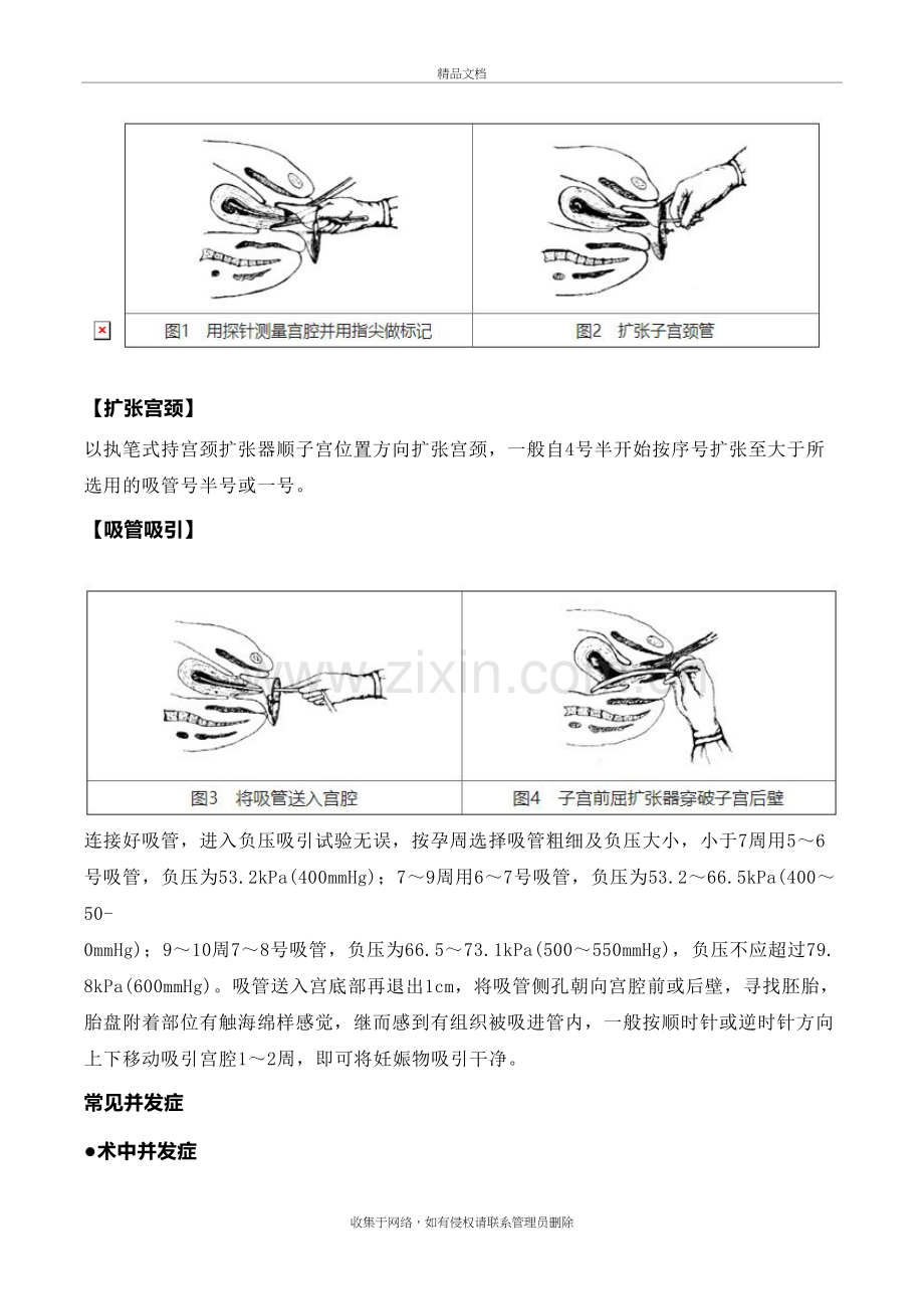 五常见妇科小手术-操作要点及注意事项教学文案.doc_第3页