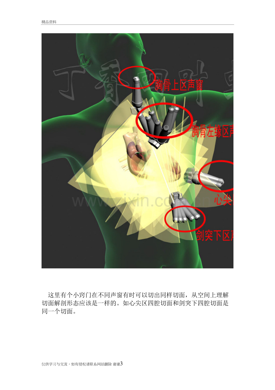 3D图解心脏解剖与心脏超声切面讲课稿.doc_第3页