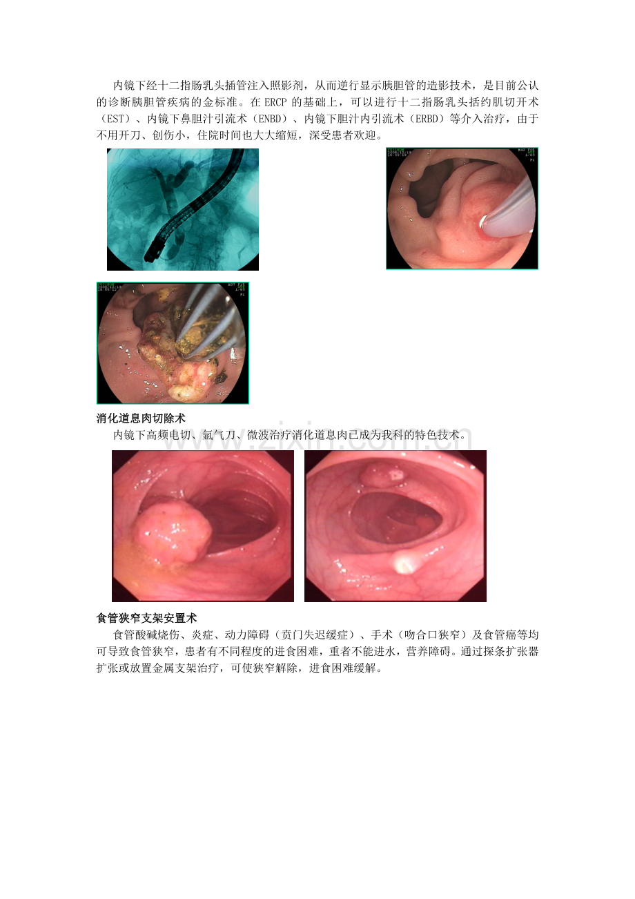 消化内科科室简介与常见病健康宣教电子教案.doc_第2页