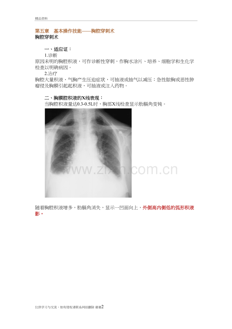 第五章-基本操作技能——胸腔穿刺术知识分享.doc_第2页