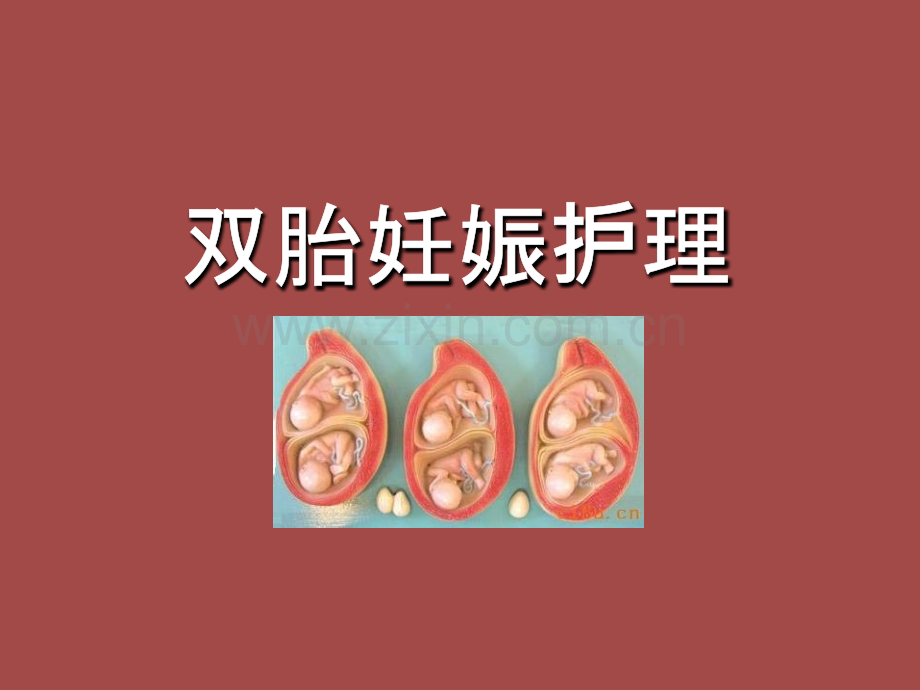 双胎妊娠护理讲课讲稿.ppt_第1页