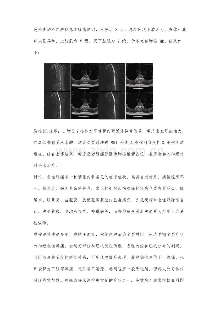 脊柱源性腹痛病例报告1例.docx_第3页