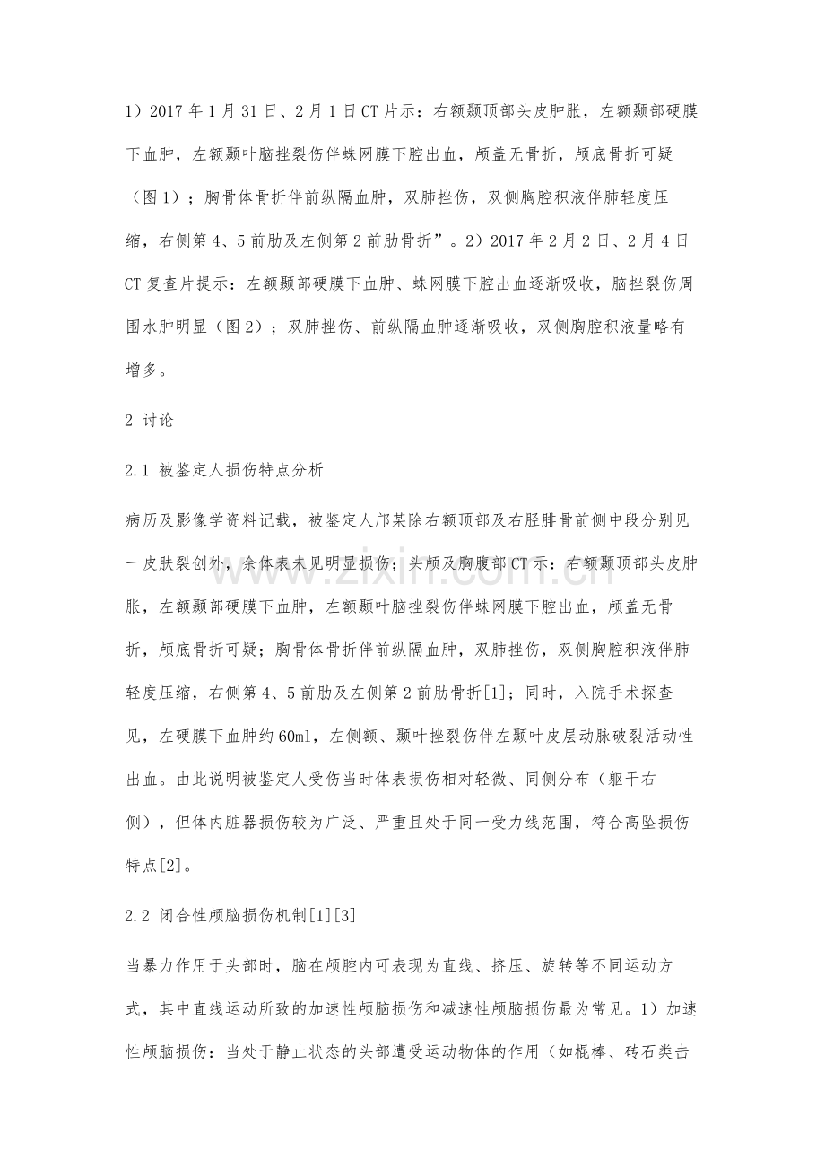 活体颅脑损伤成伤机制鉴定案例分析例.docx_第3页