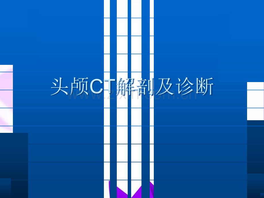 头颅CT解剖及诊断-.ppt_第1页