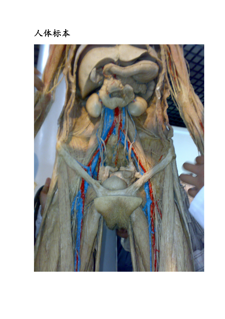 人体标本(展示图).doc_第1页