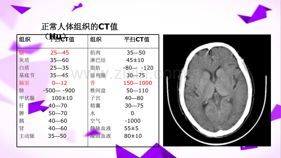 头颅CT基本知识及神经外科常见疾病CT读片-.ppt_第3页