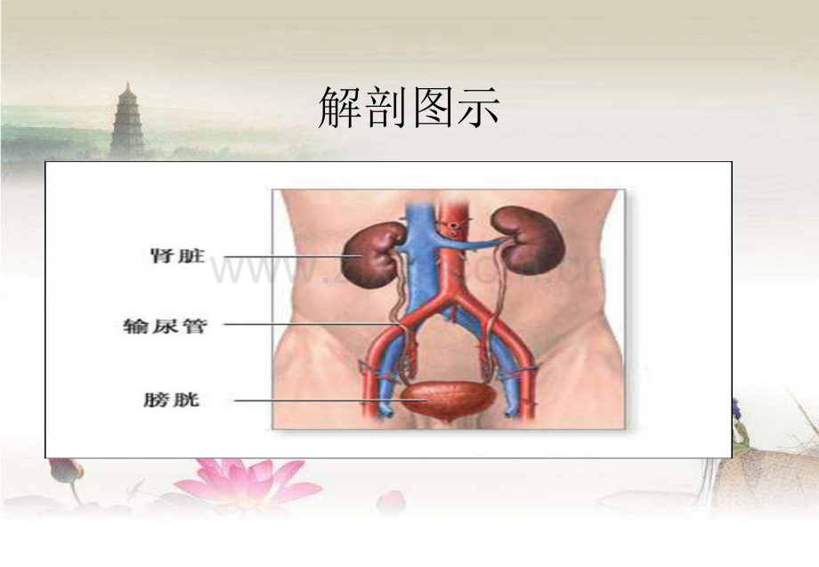 膀胱肿瘤的护理查房.ppt_第3页