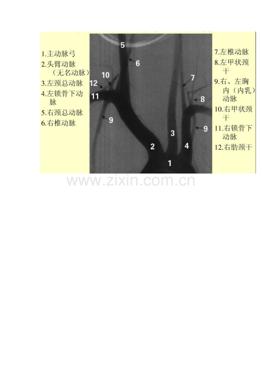 脑血管造影图片详解.doc_第3页