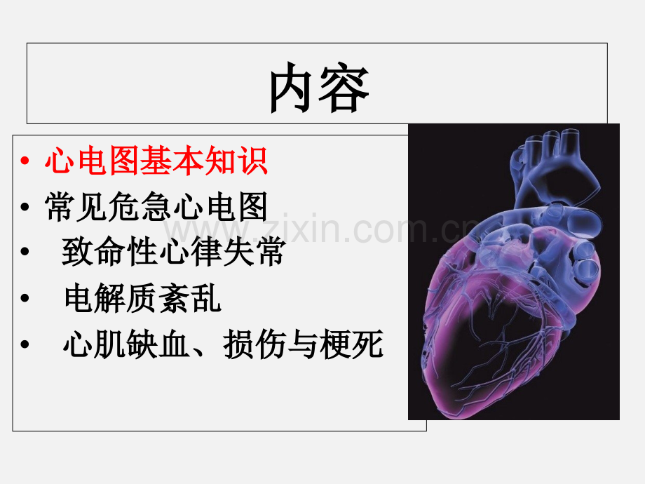 临床常见危急心电图的识别-.ppt_第2页