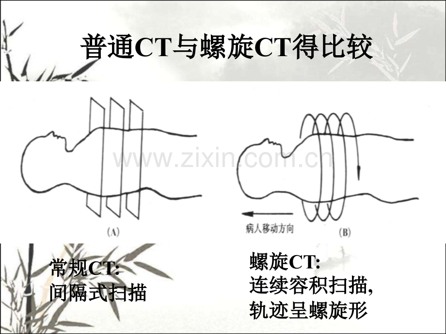 螺旋后处理技术的临床应用.pptx_第3页