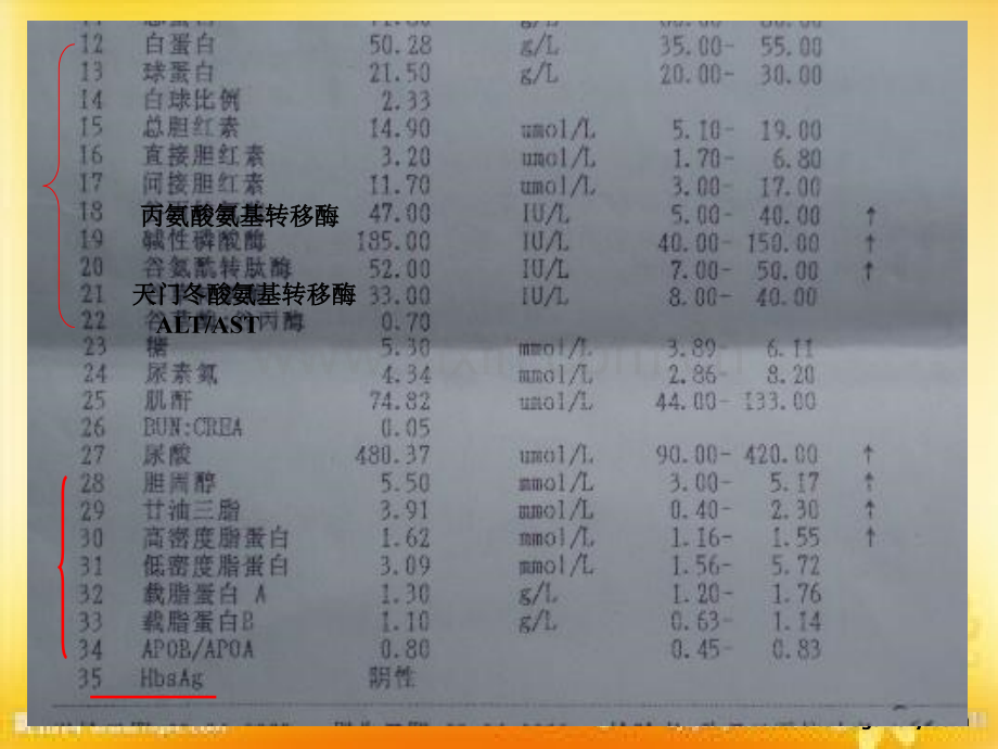 肝脏病常用实验室检查PPT.ppt_第3页