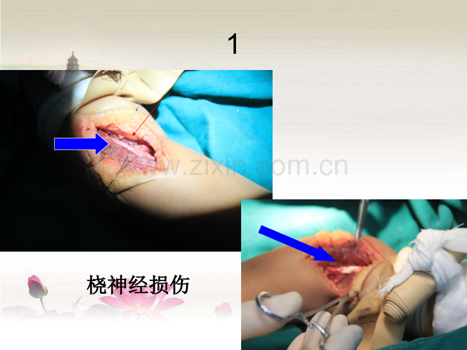 人工神经导管ppt.ppt_第3页