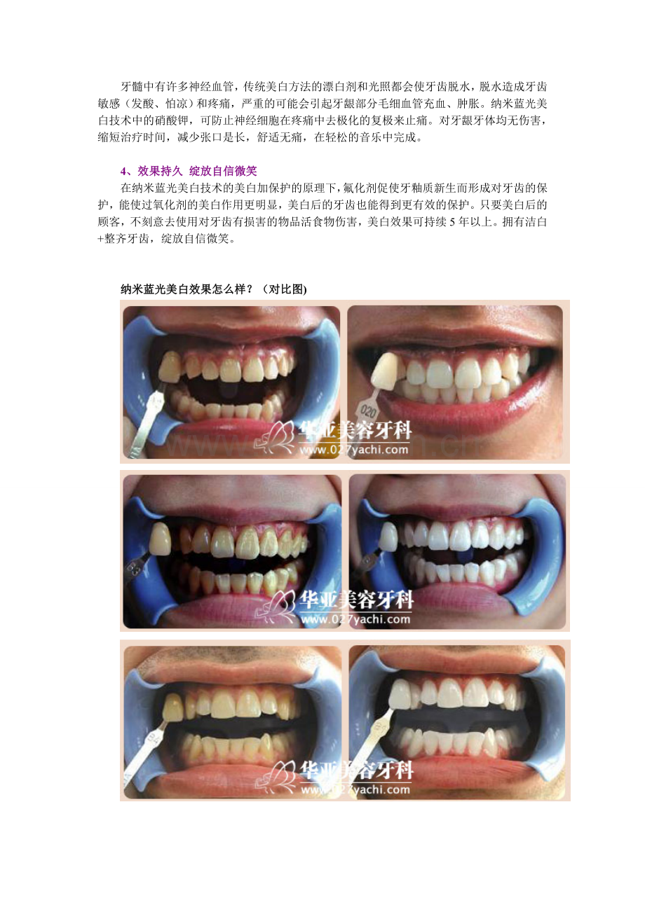 美容牙科美白团购方案.doc_第3页