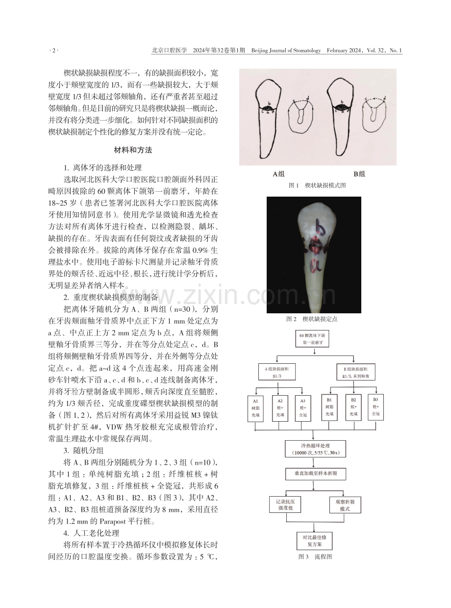 修复方式对不同面积楔状缺损抗折强度的影响.pdf_第2页