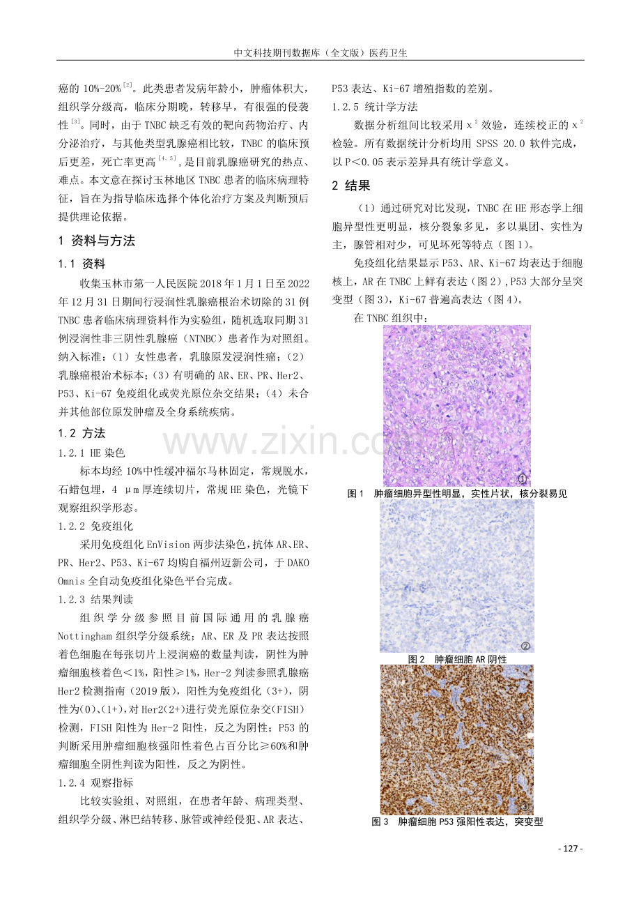 31例三阴性乳腺癌的临床病理特征分析.pdf_第2页