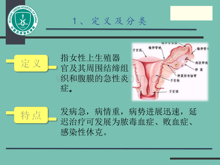 急性盆腔炎.ppt_第3页