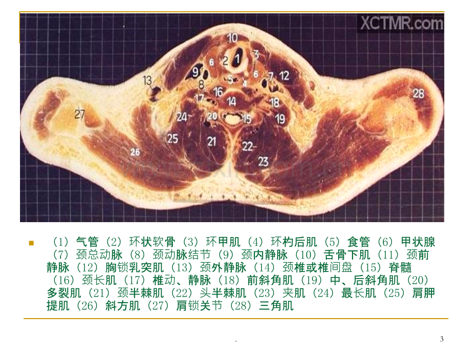 人体断层解剖图谱胸腔.ppt_第3页