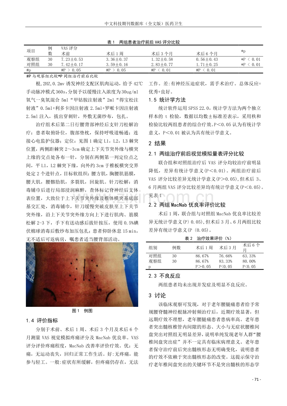 脊神经根脉冲射频联合脊神经后支针刀松解治疗老年性腰痛的临床疗效.pdf_第2页