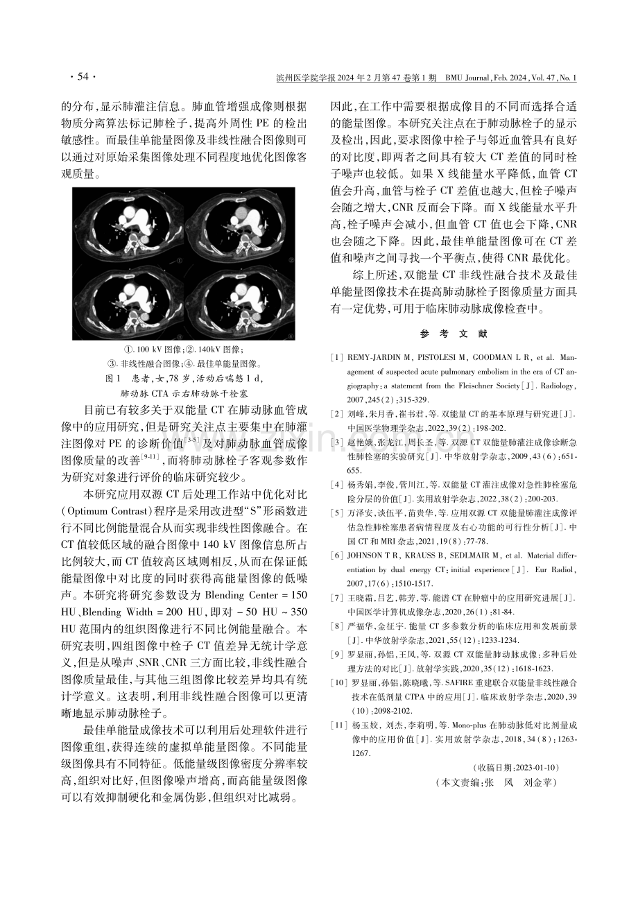 双源双能量CT图像优化技术对肺动脉成像图像质量的影响.pdf_第3页