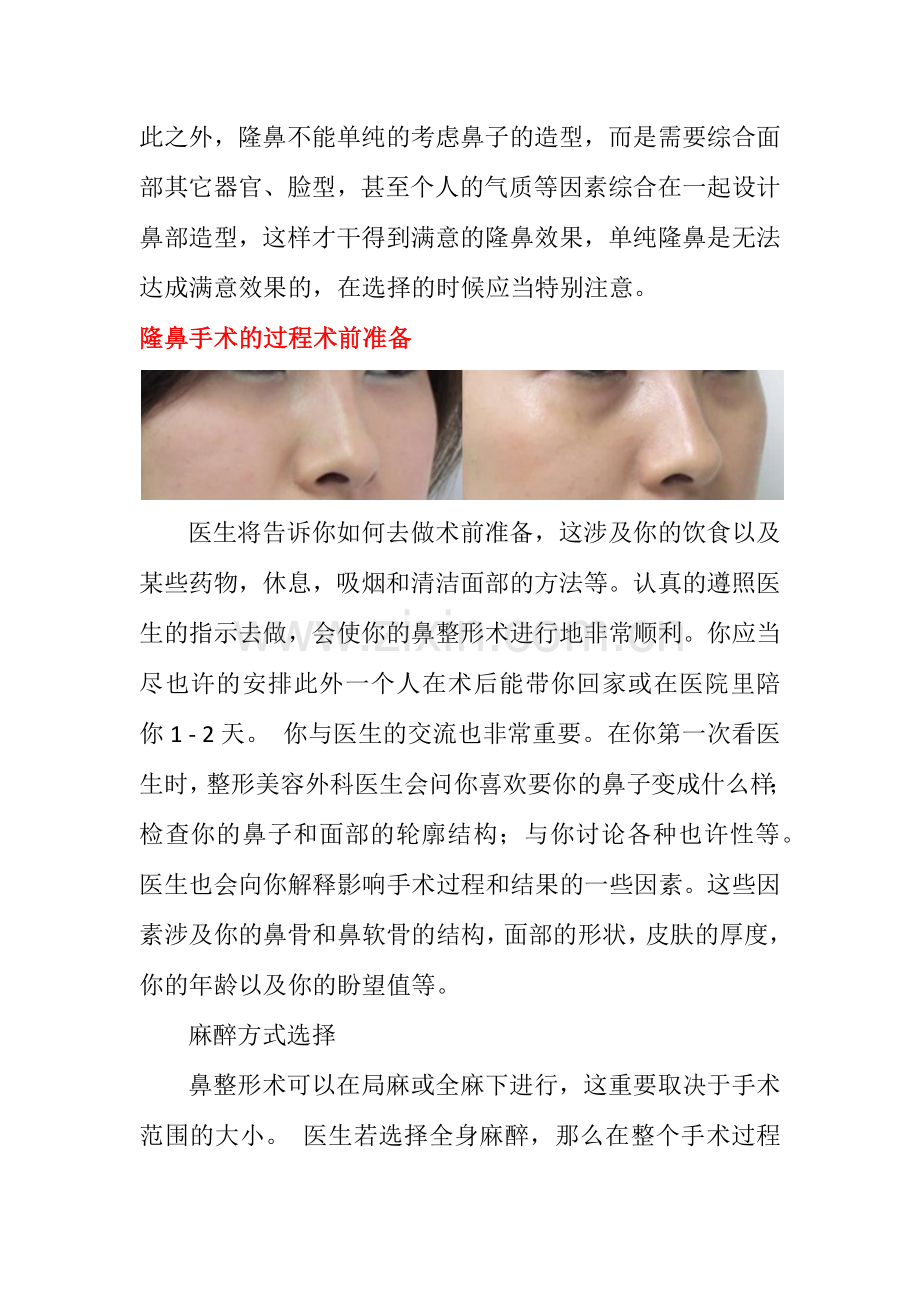 隆鼻术后注意事项.docx_第2页