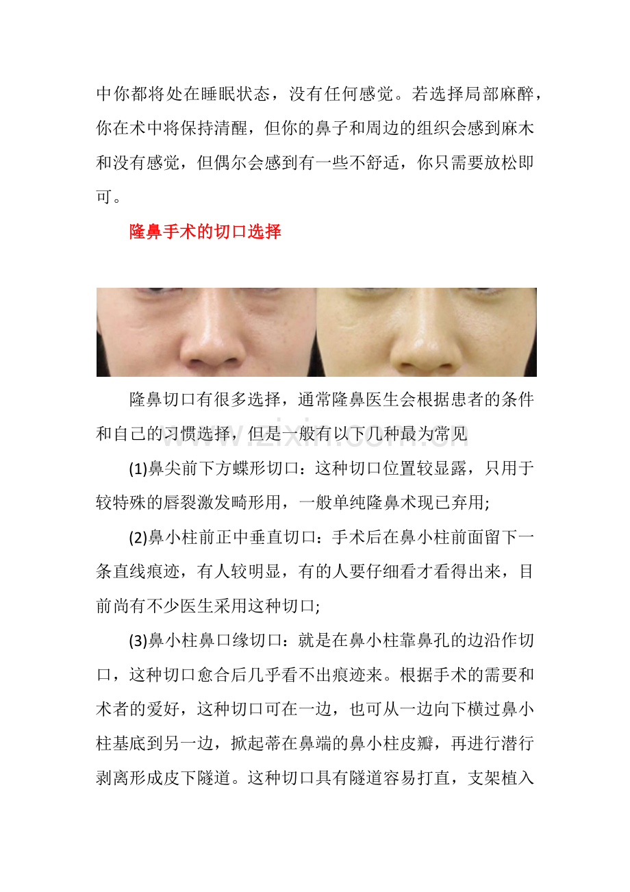 隆鼻术后注意事项.docx_第3页