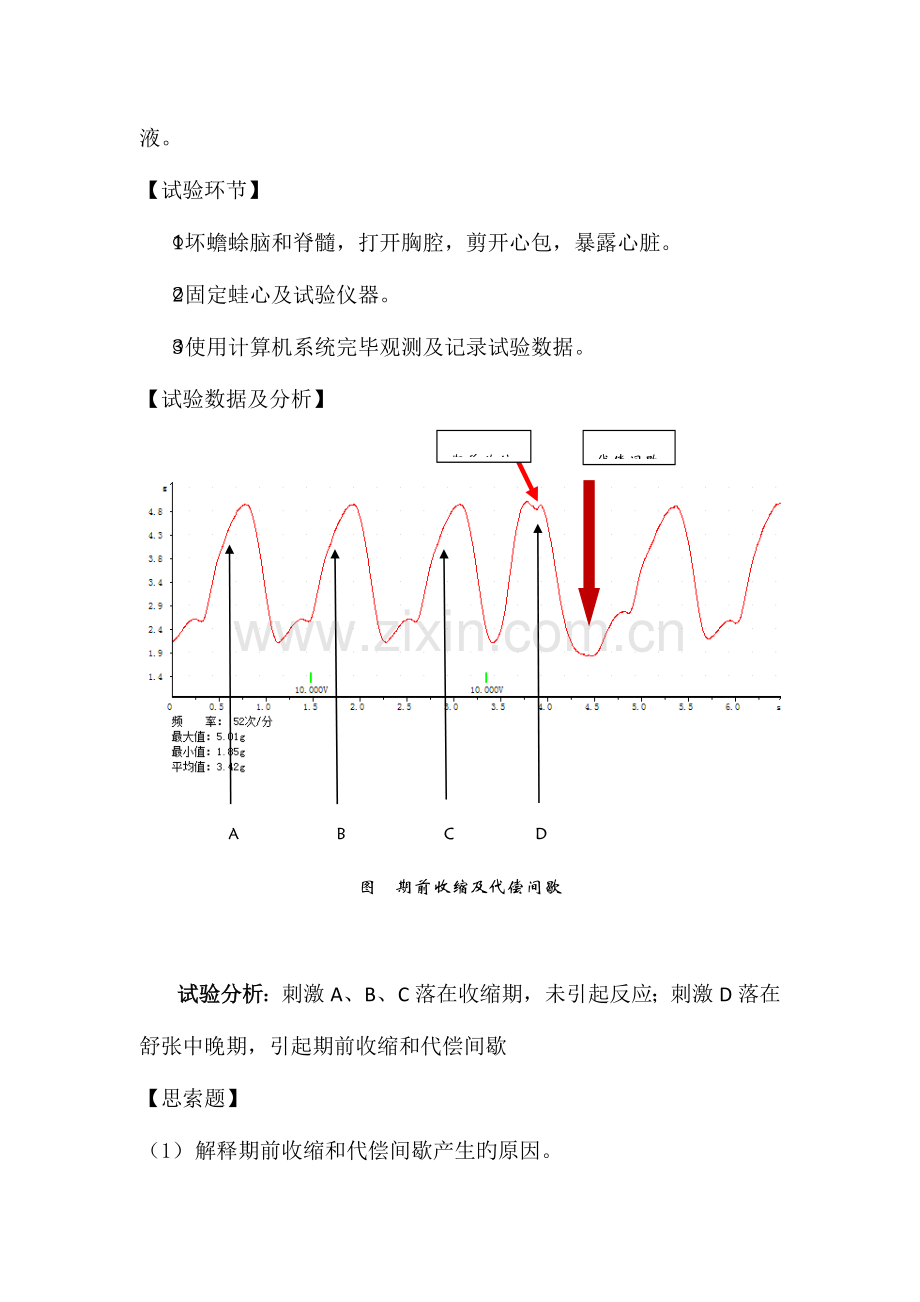 2023年机能学实验报告期前收缩和代偿间歇.docx_第2页