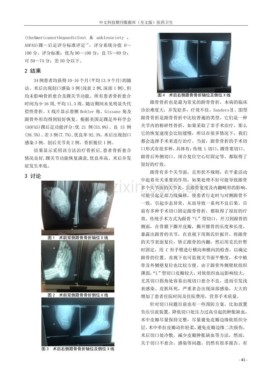 跟骨后外侧小切口联合跗骨窦切口钢板内固定治疗SandersⅡ型、Ⅲ型跟骨骨折研究.pdf_第3页