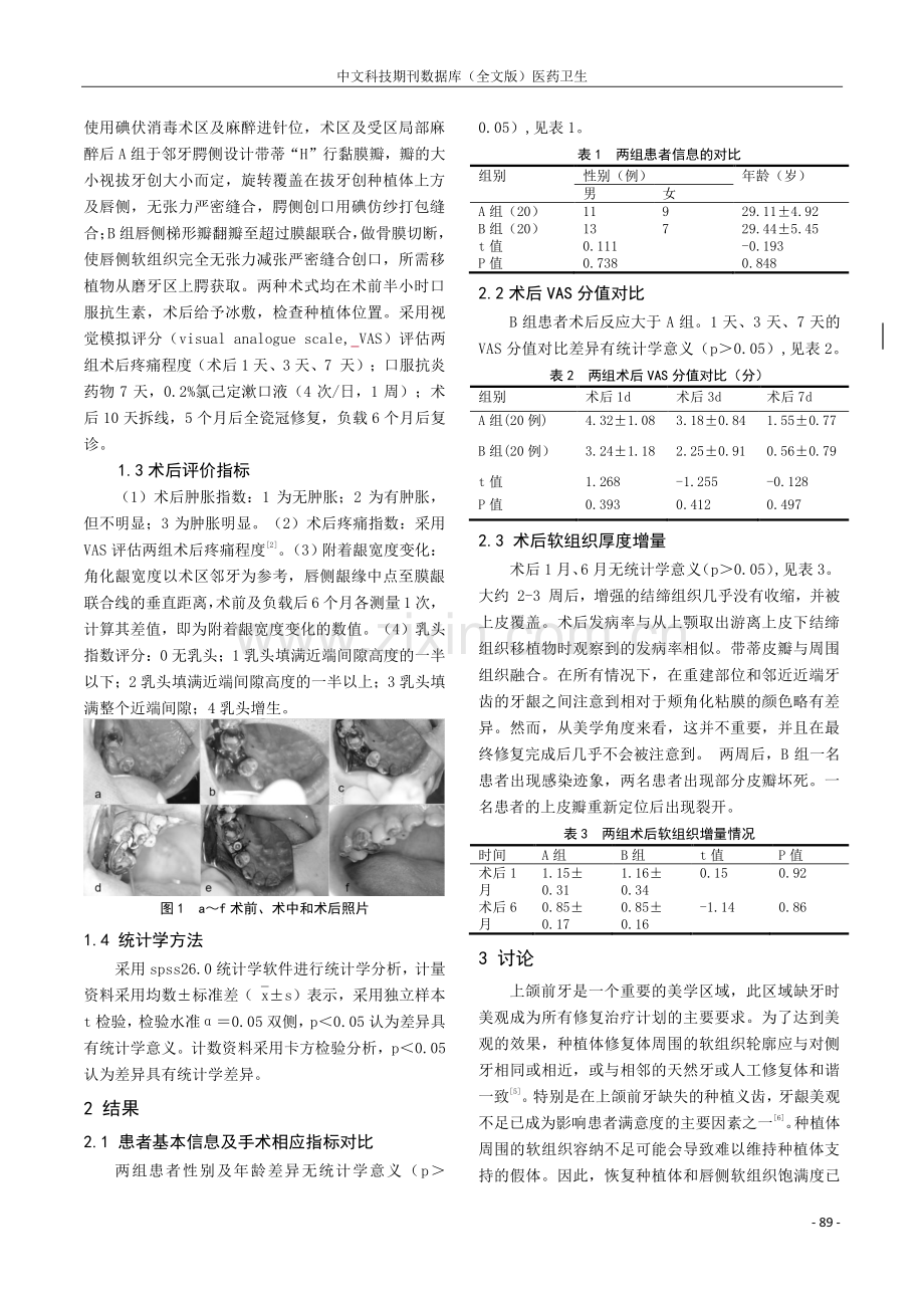 腭侧带蒂结缔组织旋转瓣在上前牙种植软组织增量中的临床应用研究.pdf_第2页