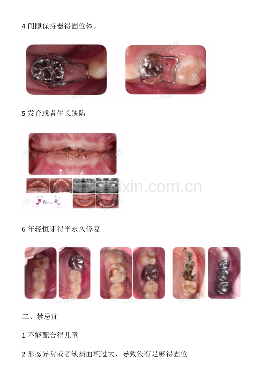 一步一步做好乳牙预成冠预成冠.doc_第3页