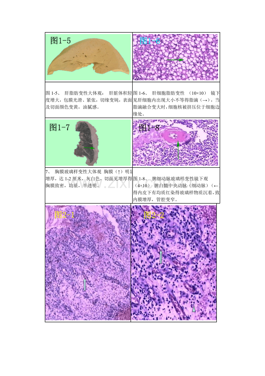 病理切片.doc_第1页