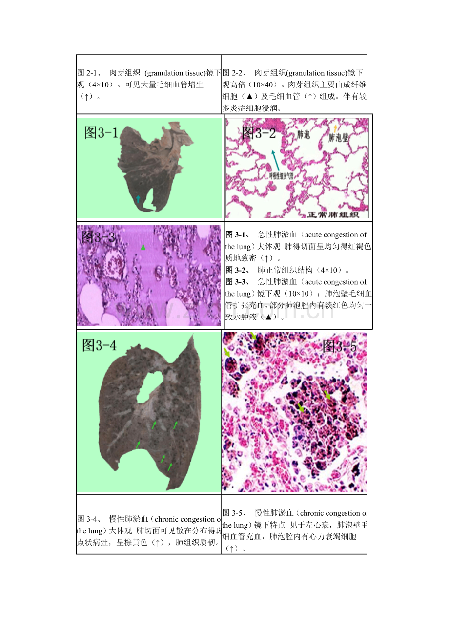 病理切片.doc_第2页