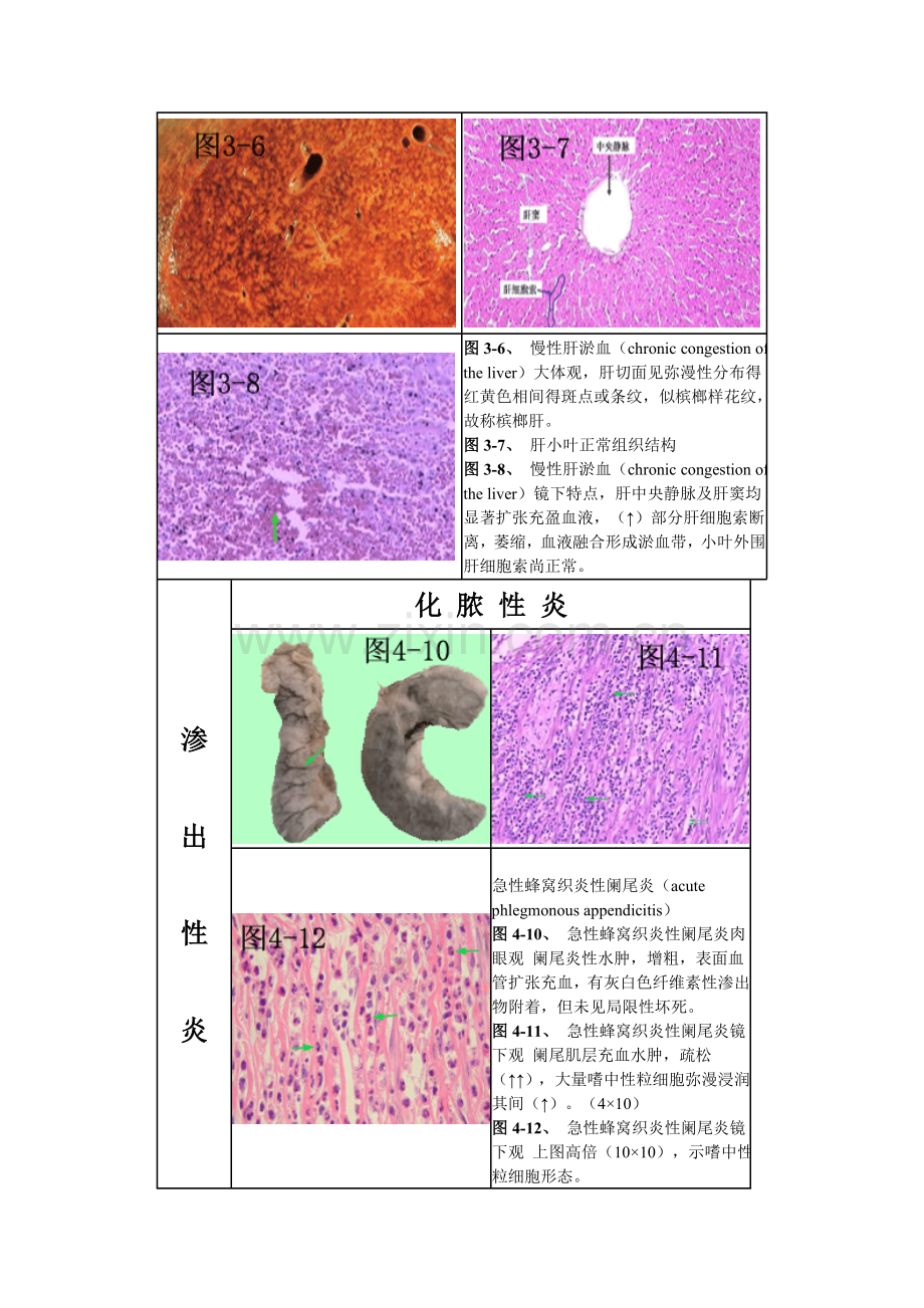 病理切片.doc_第3页