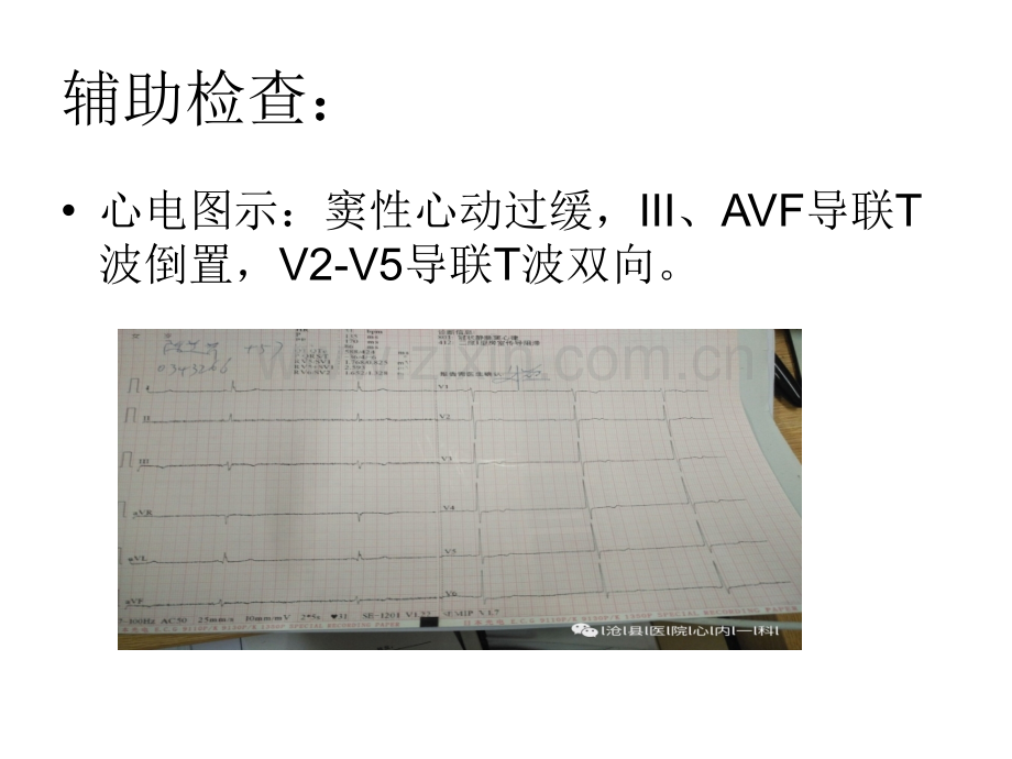 心源性晕厥行心脏起搏器植入术课件.ppt_第2页