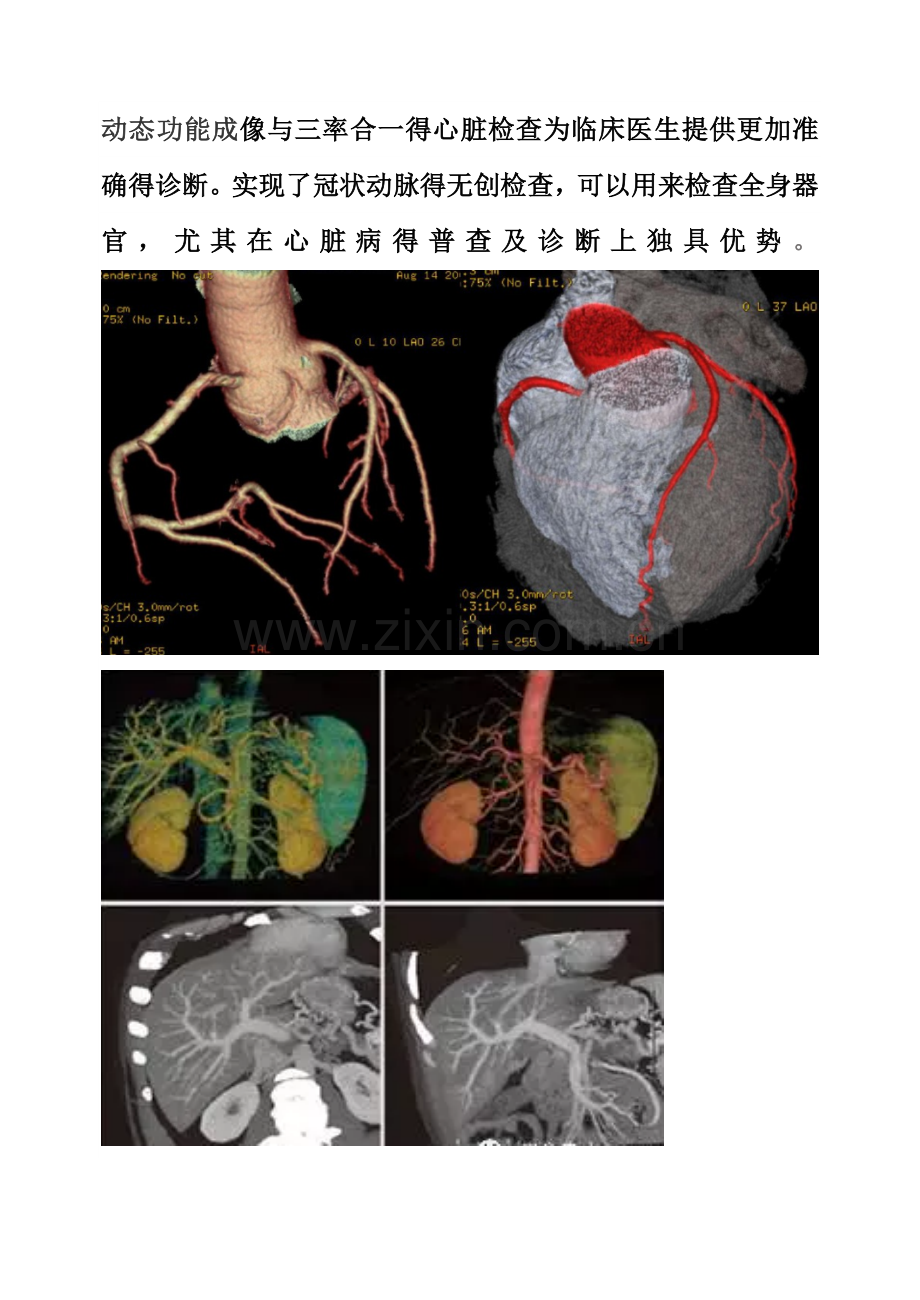 optima冠脉CT.doc_第2页