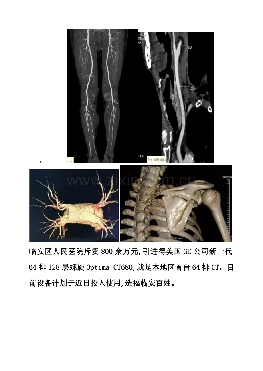 optima冠脉CT.doc_第3页