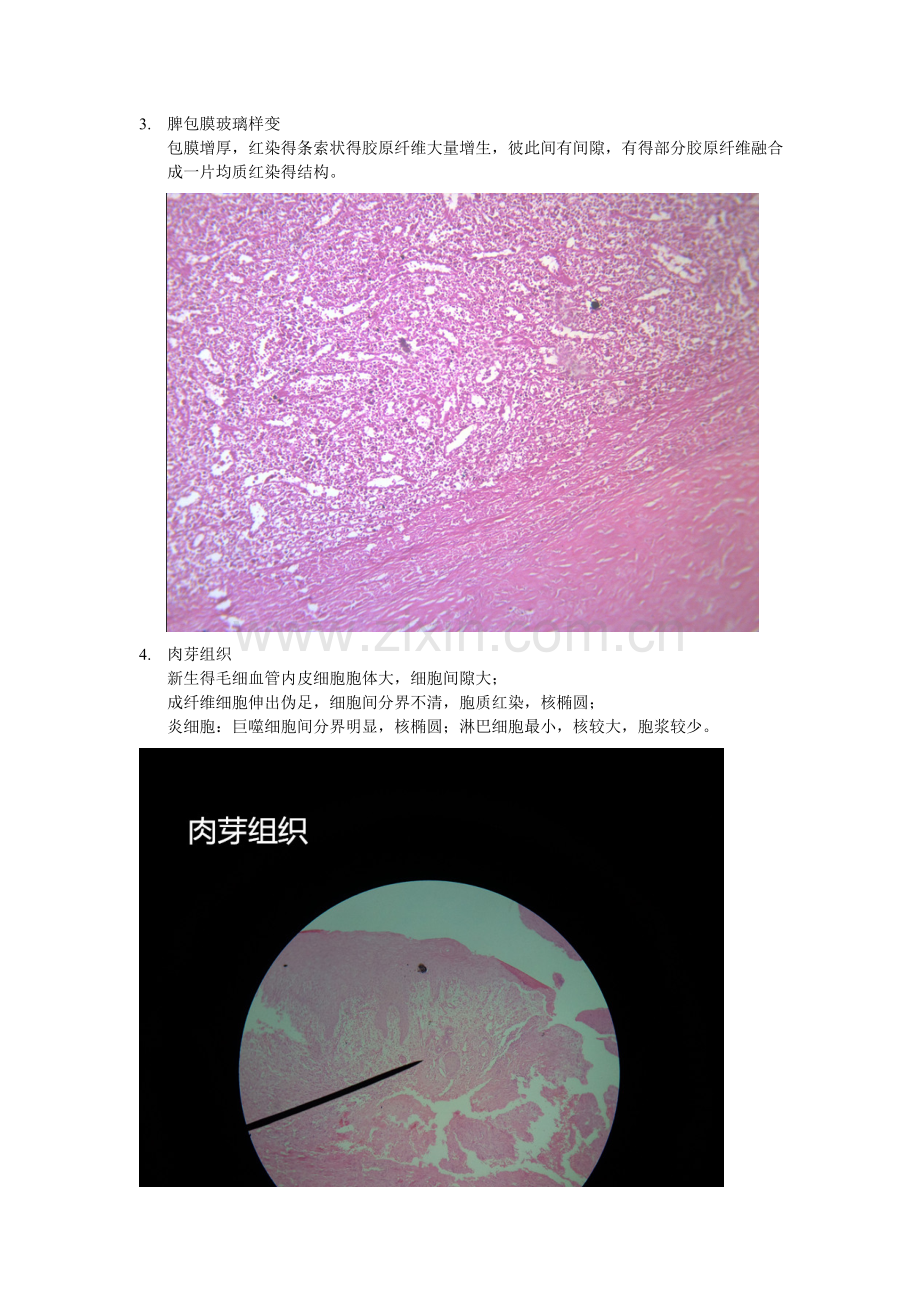 病理学-镜下切片.doc_第3页