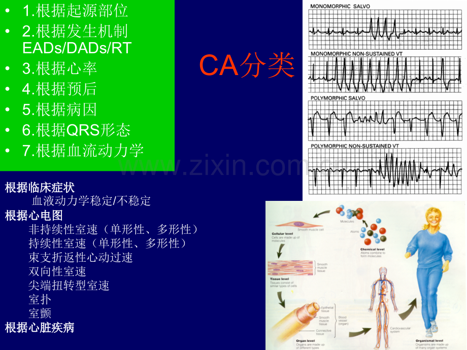 A1.心律失常诊治进展.ppt_第3页