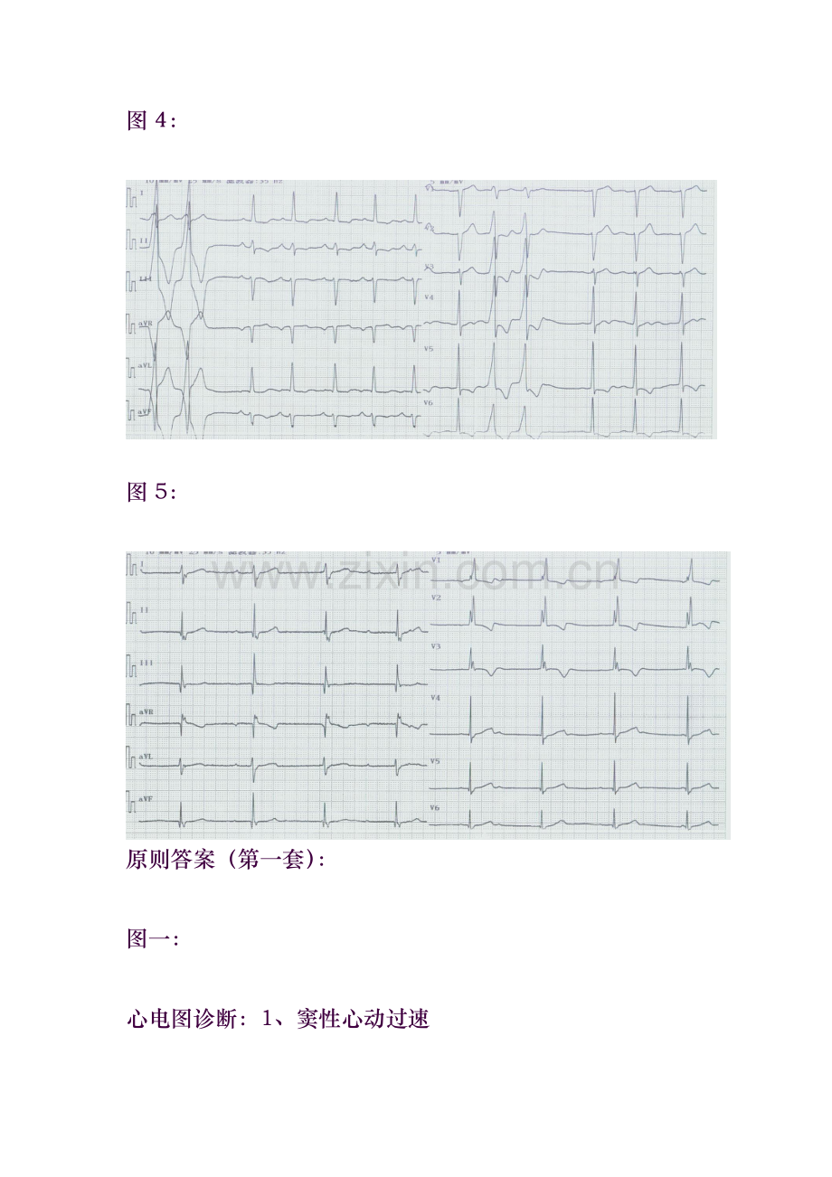 心电图试题及标准答案.doc_第3页