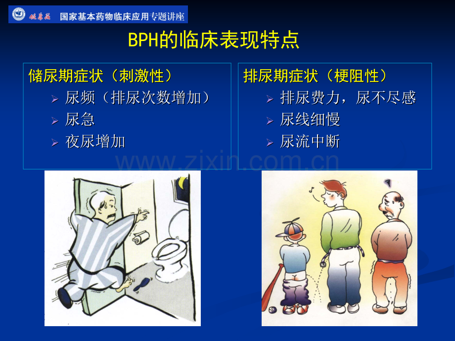 BPH药物治疗课件.ppt_第3页