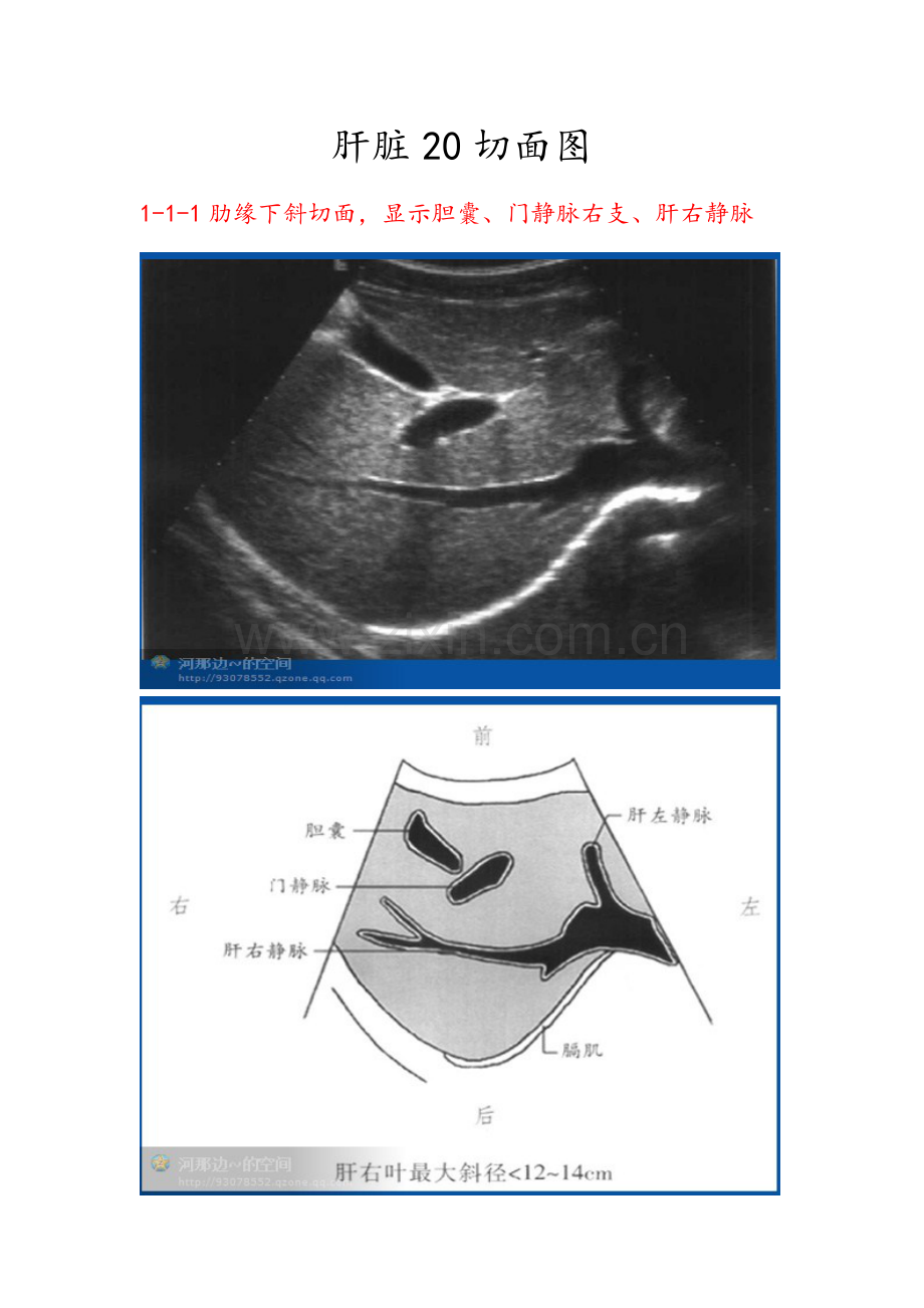 肝脏超声20个切面.doc_第1页