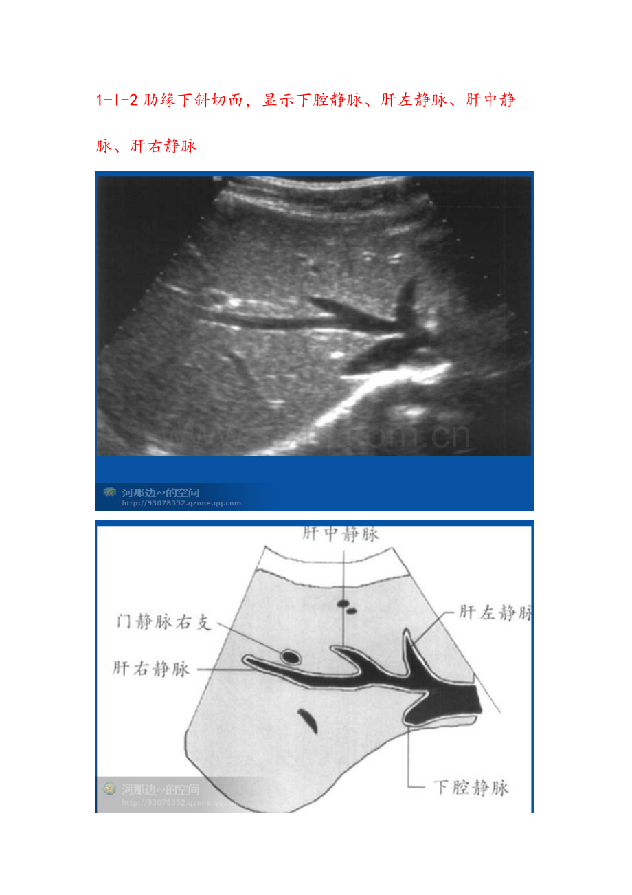 肝脏超声20个切面.doc_第2页