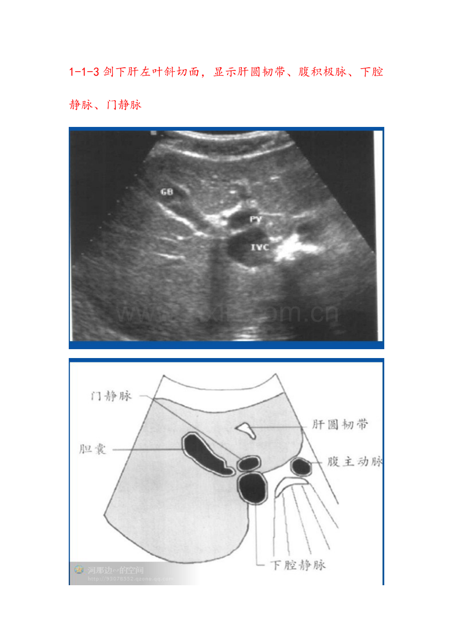 肝脏超声20个切面.doc_第3页