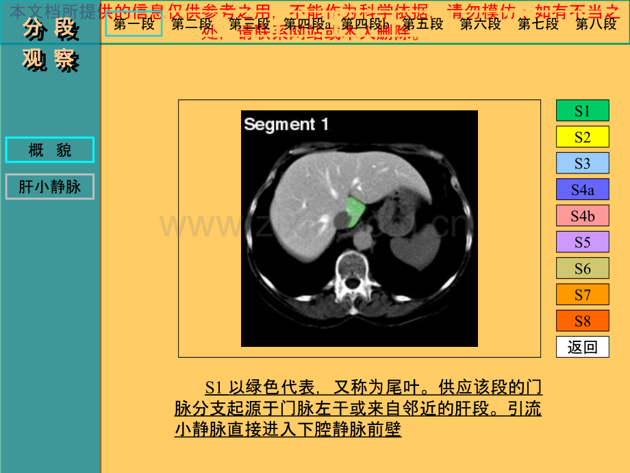 肝脏CT解剖图记忆培训课件.ppt_第3页