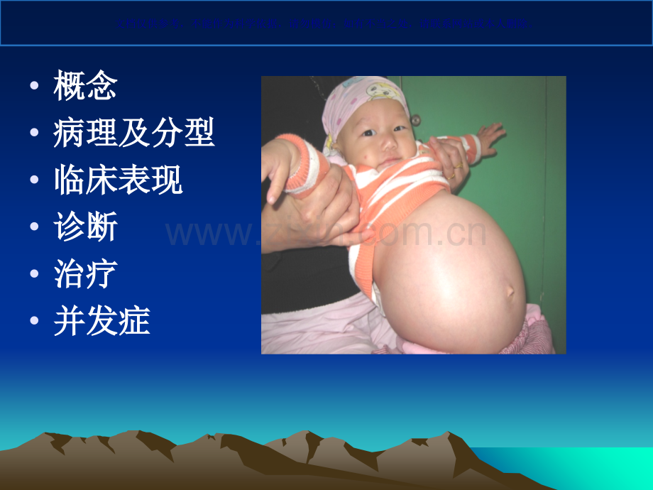 先天性巨结肠课件.ppt_第1页