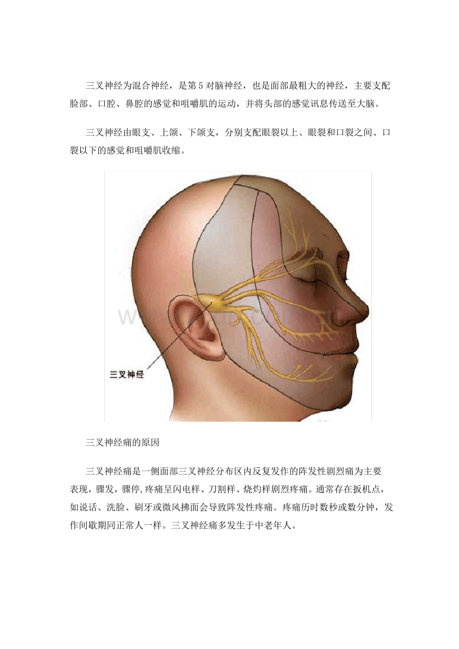 (图解)微血管减压手术治疗三叉神经痛的过程.pdf_第1页