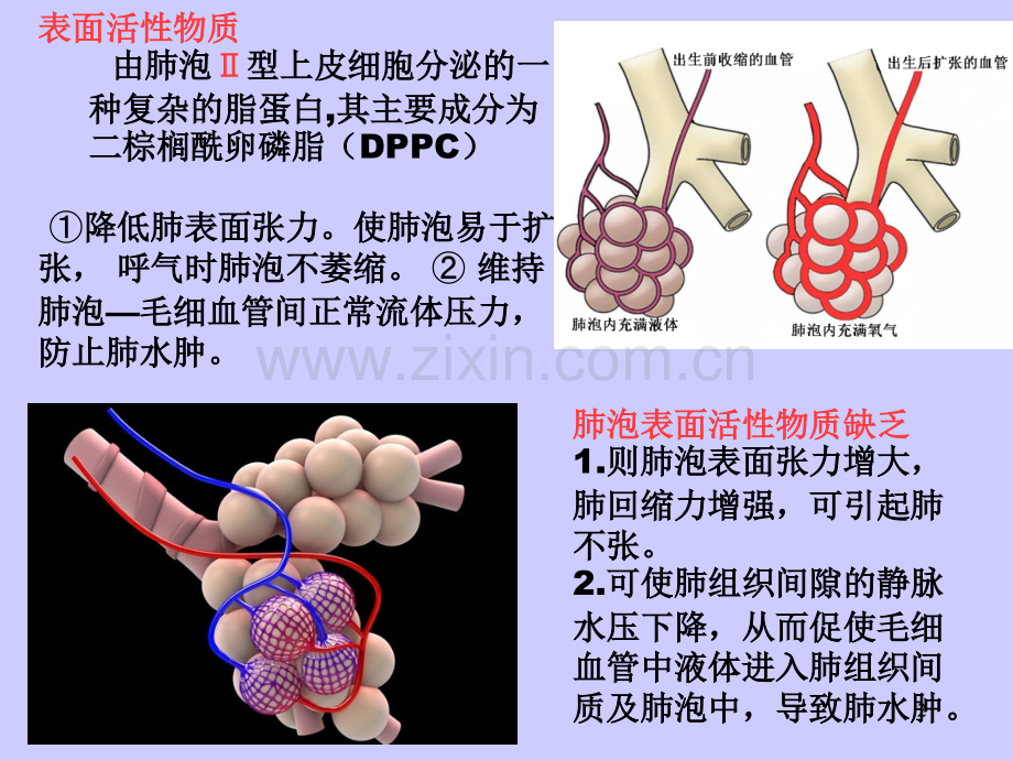 新生儿呼吸窘迫综合征(有些总结).ppt_第2页